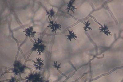 muffa da umido di risalita Cladosporium